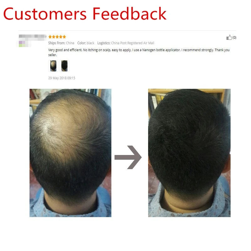 Blender Conceal Styling Fiber Hair Powders Thinning Loss Building Hair Fibers Keratin Eyelash Extension 100g Black 10 Colors