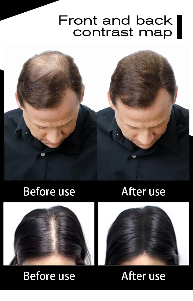 Blender Conceal Styling Fiber Hair Powders Thinning Loss Building Hair Fibers Keratin Eyelash Extension 100g Black 10 Colors